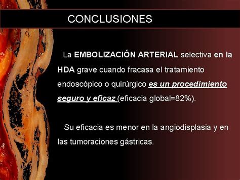 Embolizacin Arterial En La Hemorragia Digestiva Alta Severa