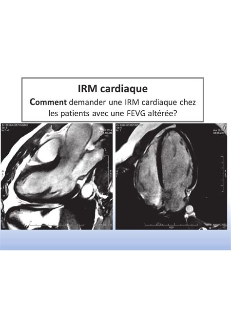 L Irm Quand Et Comment Demander Une Irm Cardiaque