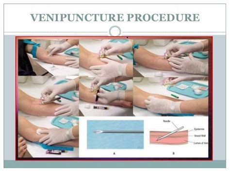 Phlebotomy