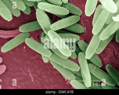 Scanning electron Microscope image of Mosquito proboscis magnified approximately 390X (color ...