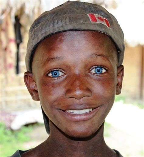 20 Amazing Pictures Of Black People With Blue Eyes