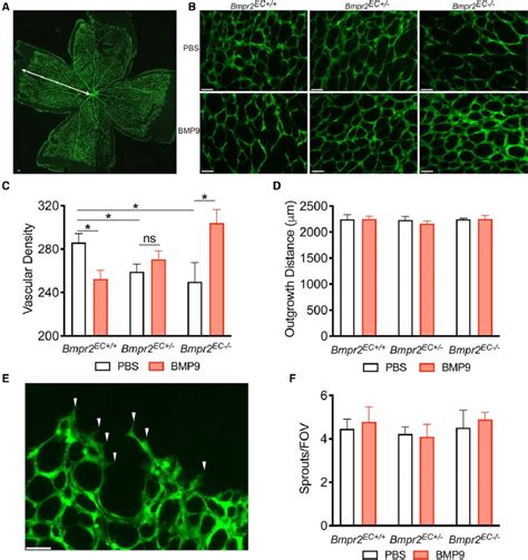 Endothelial Bmpr Expression Dictates The Impact Of Systemic Bmp Bone