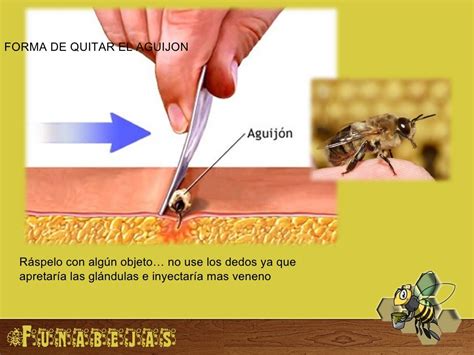 Picadura De Abeja Funabejas