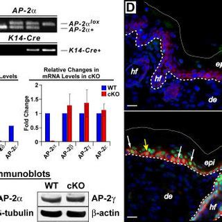 Targeted Ablation Of Ap Gene Expression In Mouse Epidermis