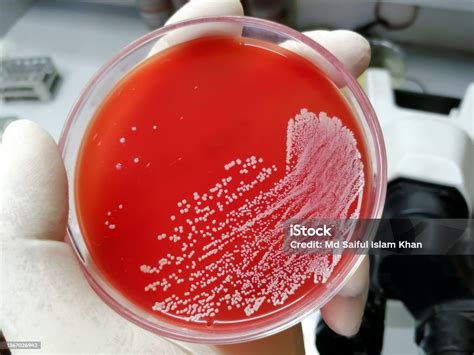 Staphylococcus Aureus Grampositif Untuk Gramvariabel Bakteri