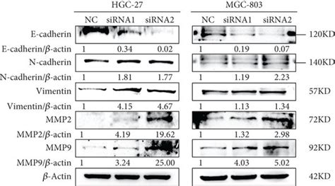 CDR1as Knockdown Promotes Migration And Invasion Of GC Cells A B