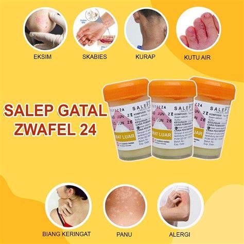 Jual Salep Zwafel Obat Salep Gatal Paling Ampuh Gatel Kulit Panu