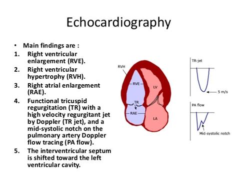 Radiology Of Pulmonary Hypertension