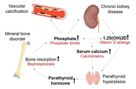 Cardiovascular Calcification In Chronic Kidney Disease Therapeutic