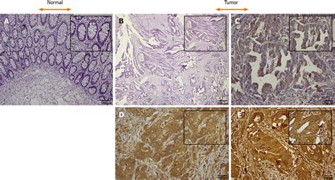 Representative Images Of Immunohistochemical Expression Of The