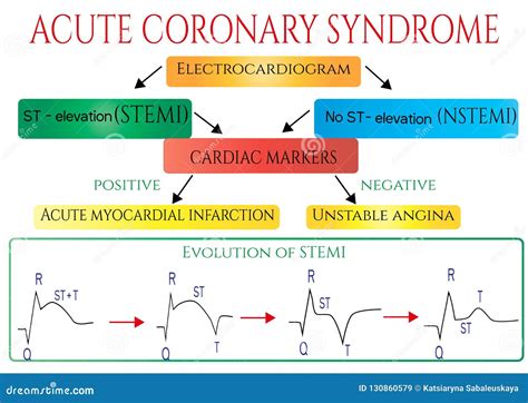 Acute Coronary Syndrome Cartoon