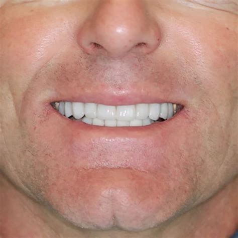 Smile Gallery Marcus Black Dds Best Dentist In Rogers Ar