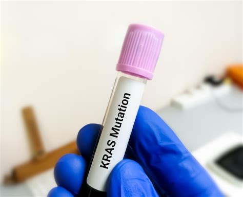 Premium Photo Molecular Biologist Hold Blood Sample For Kras Mutation