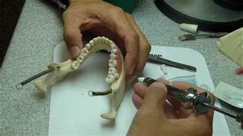 intraosseous anesthesia stabidentxtip youtube