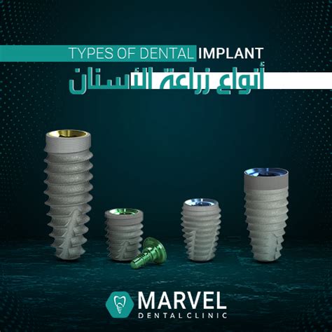 Types of dental implants | Marvel Dental Clinic - Cosmetic dentistry in ...