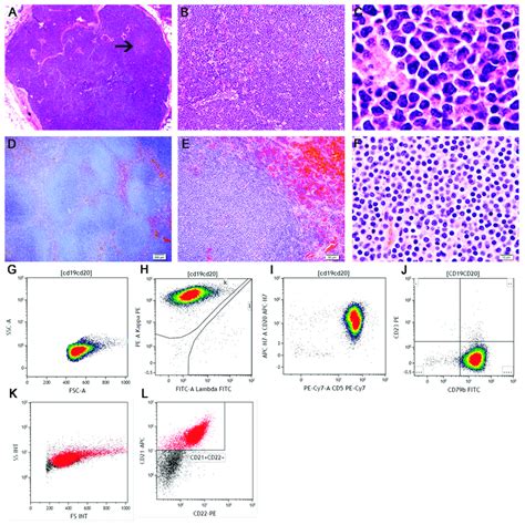 The Histologic And Flow Cytometric Features Of Human And Canine Mantle