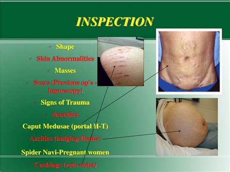 Ppt Abdominal Examination Powerpoint Presentation Free Download Id 9699544