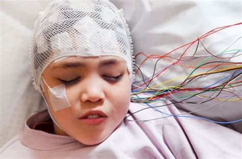 SIGNS YOUR CHILD MAY HAVE EPILEPSY - EpilepsyU