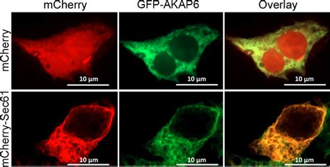 Gfp Akap Localized To The Endoplasmic Reticulum In Hek T Cells