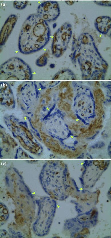 Immunohistochemical Visualization Of The Receptor Cx Cr In Placental