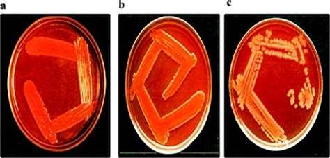 Shigella Flexneri Características Morfología Ciclo De Vida Enfermedades