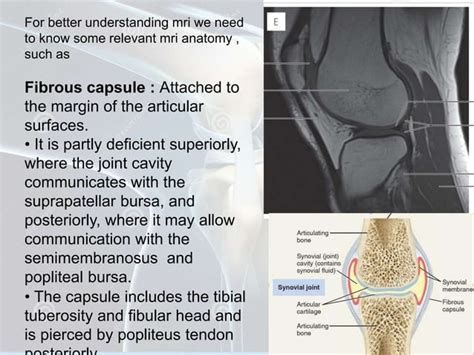 Radiological Anatomy Of Knee Joint Pptx