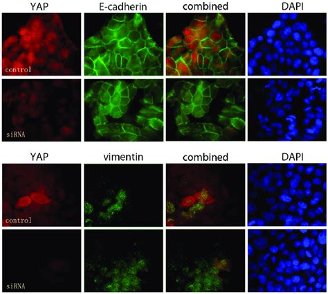 Yap Expression Does Not Affect E Cadherin And Vimentin Localization In