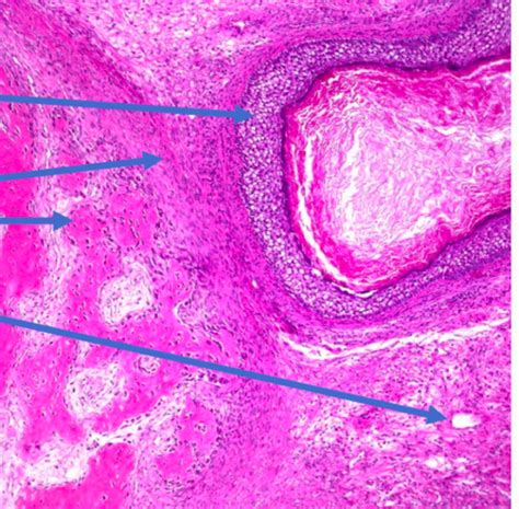 Cancer Histology Id Flashcards Quizlet