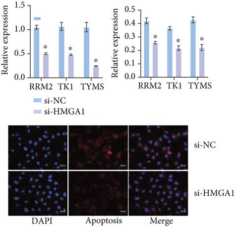 Knocking Down LncRNA IGF2 AS Down Regulated DNTP Metabolization Related