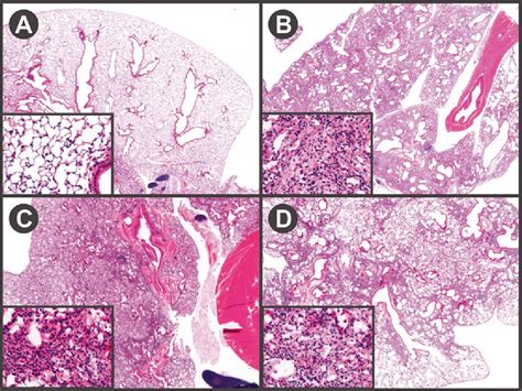 The Bleomycin Model Of Pulmonary Fibrosis Semantic Scholar