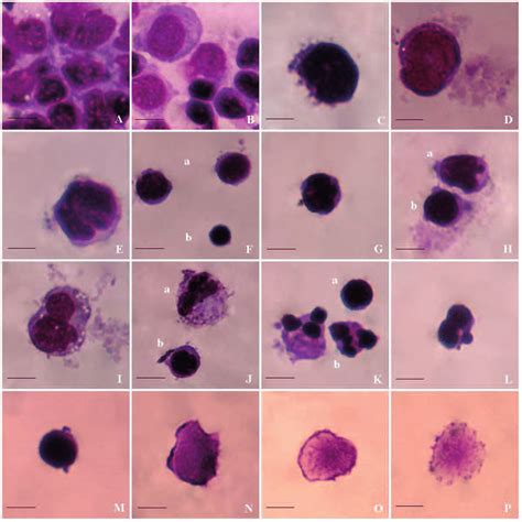 Activated Lymphocytes Hot Sex Picture