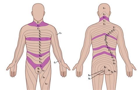 The Role Of The Neurometer Cpt C In Sacral Neuromodulation Abstract