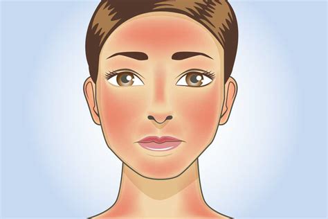 How To Treat Skin Redness (Erythema); 10 Common Causes of Redness - A2Z ...