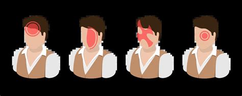 Best Headache Types Illustration download in PNG & Vector format