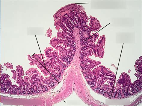 jejunum 1 Diagram | Quizlet