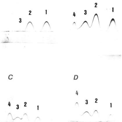 Crossed Affinity Immunoelectrophoresis Of Alpha Acid Glycoprotein A