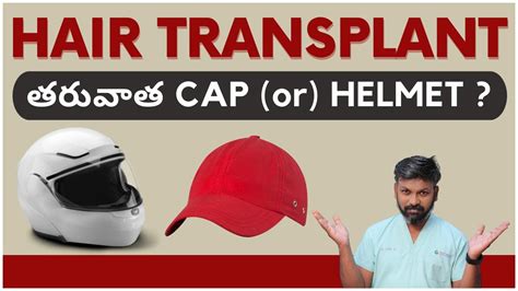 Drjohnwatts When Can You Wear Helmets Or Caps After A Hair Transplant Explained Youtube