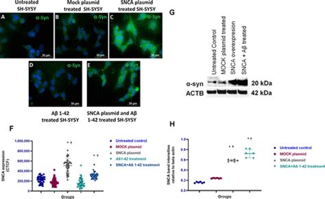 Amyloid βα Synuclein And Amyloid β α Synuclein Combination Exert