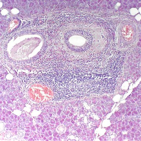 A He Stained Section In The Submandibular Gland Showing Intraductal