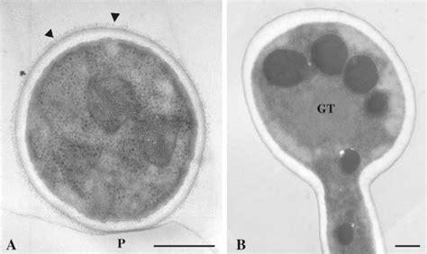 Transverse Sections Of Candida Albicans Germ Tubes Gt Adherent To A Download Scientific