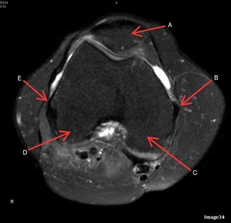 Mri Flashcards Quizlet