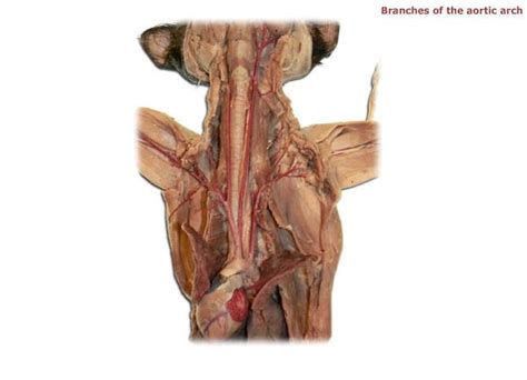 Aortic Arch Branches Diagram Quizlet