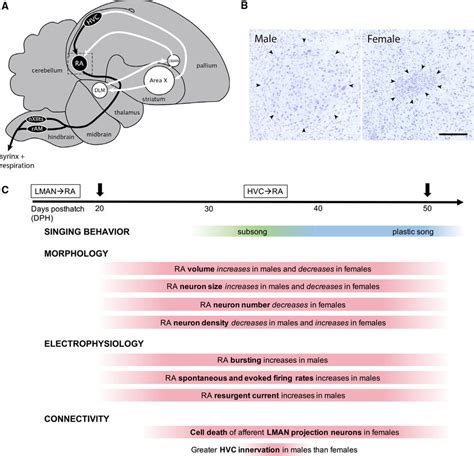 Sexually Dimorphic Development Of The Song Nucleus Ra A A Simplified