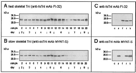 Western Blot Analysis Of Serum Fast A And Slow B Stni And Of