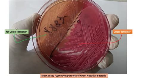 MacConkey Agar : Introduction, Principle, Composition, Preparation, Pro