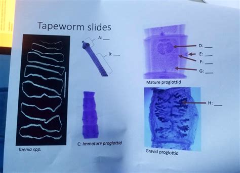 Taenia Mature Proglottid Label