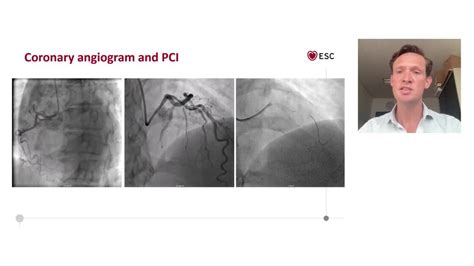 Esc 365 Personalised Cvd Prevention The Evidence Behind The Current