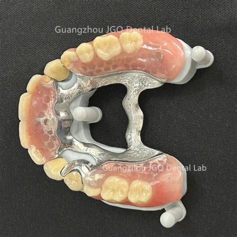 Natural Looking Removable Partial Denture Cheap Price From China Dental