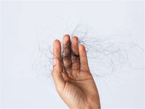 Hair Loss After Covid 19 Why It Happens And How To Treat It Self