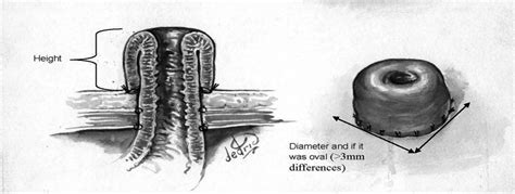 Journal of Wound Ostomy & Continence Nursing